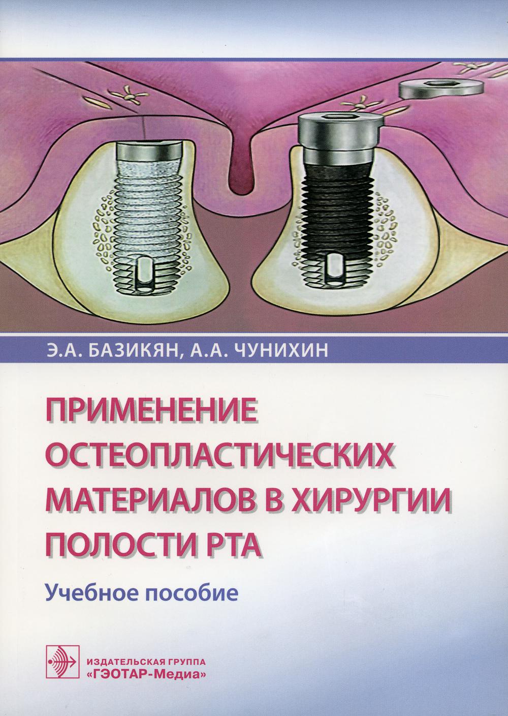 La présentation des matériaux ostéoplastiques dans la hiérarchie des postes de travail est effectuée de manière appropriée (en fonction des besoins des spécialistes en la matière). 31.05.03 «Стоматология»)