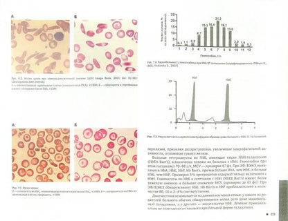 Гемоглобинопатии и талассемические синдромы. Под ред. Румянцева А.Г.