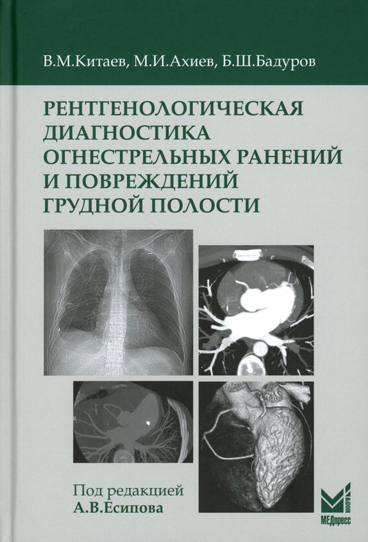 Рентгенологическая диагностика огнестрельных ранений и повреждений грудной полости. 2-е изд., перераб. и доп
