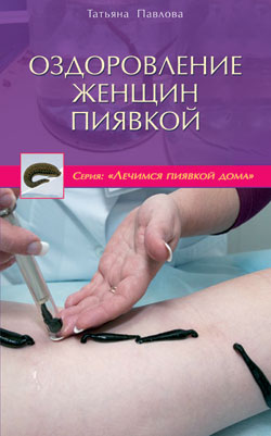 Оздоровление женщин пиявкой