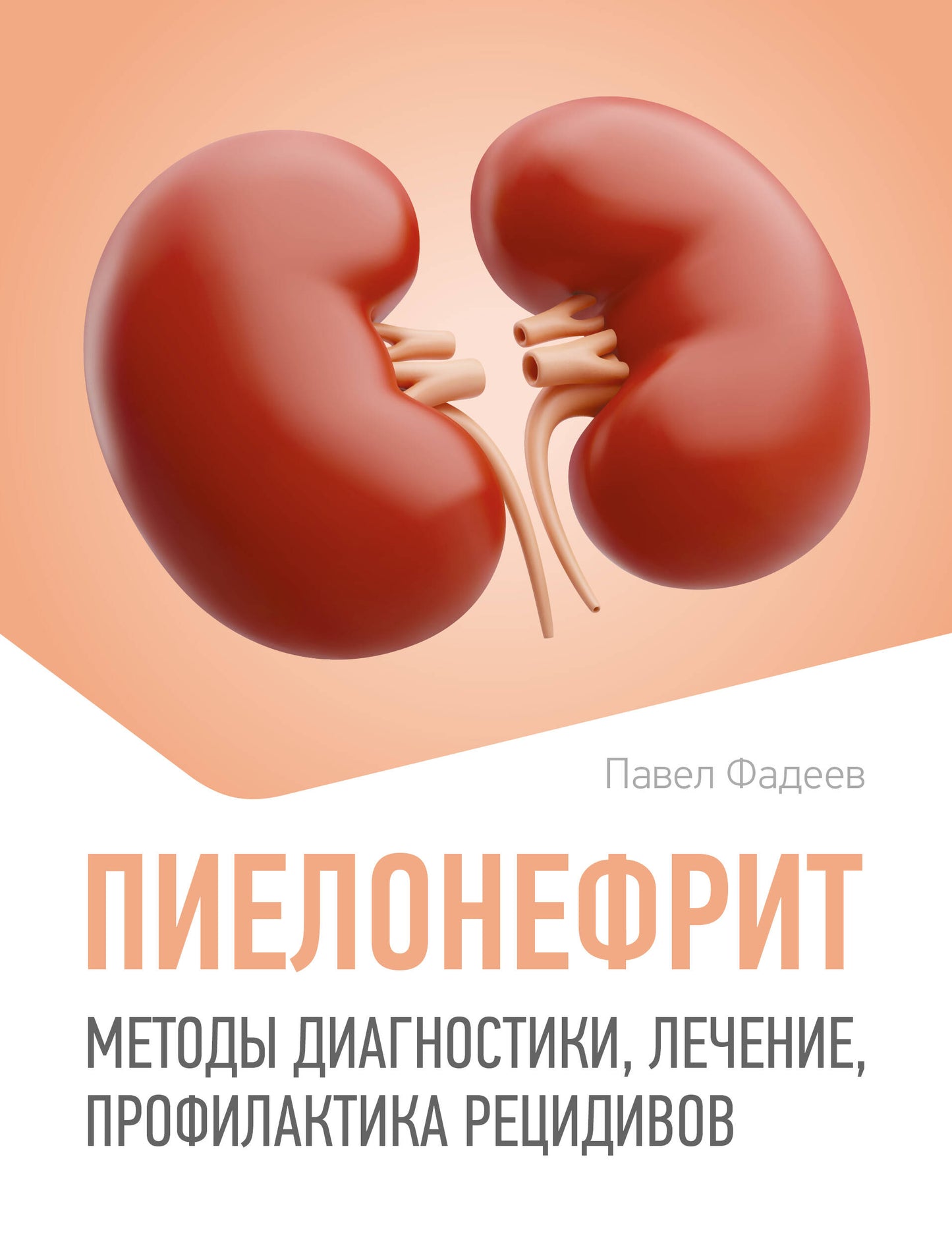 Пиелонефрит. Méthodes de diagnostic, de diagnostic et de solutions professionnelles