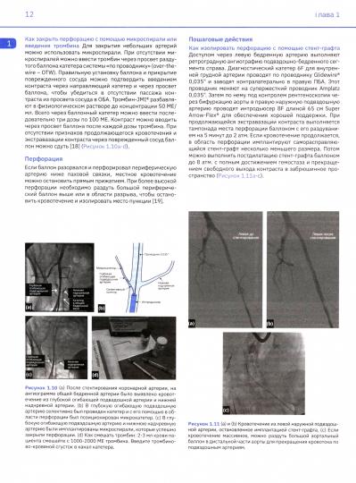 Cardiologie d'intervention. Практическое руководство. 2-е изд., перераб.и доп