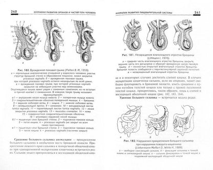 Аномалии развития органов и частей тела человека