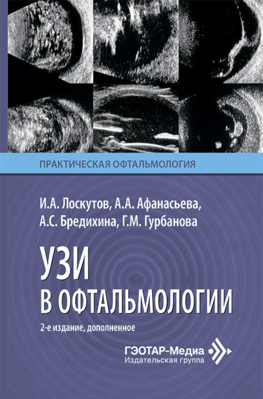 УЗИ в офтальмологии. 2-е изд., доп