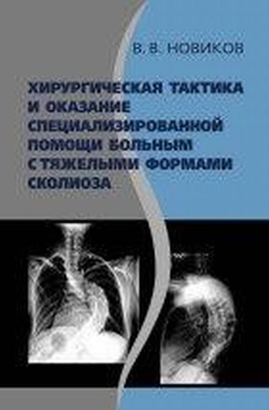 Хирургическая тактика и оказание специализированной помощи больным с тяжелыми формами сколиоза
