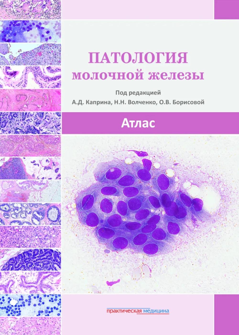 Патология молочной железы. Atlas