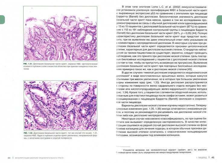 Интерпретация биопсий пищеварительного тракта. Новообразования. Том 2