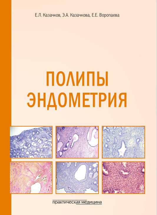 Полипы эндометрия: учебное пособие