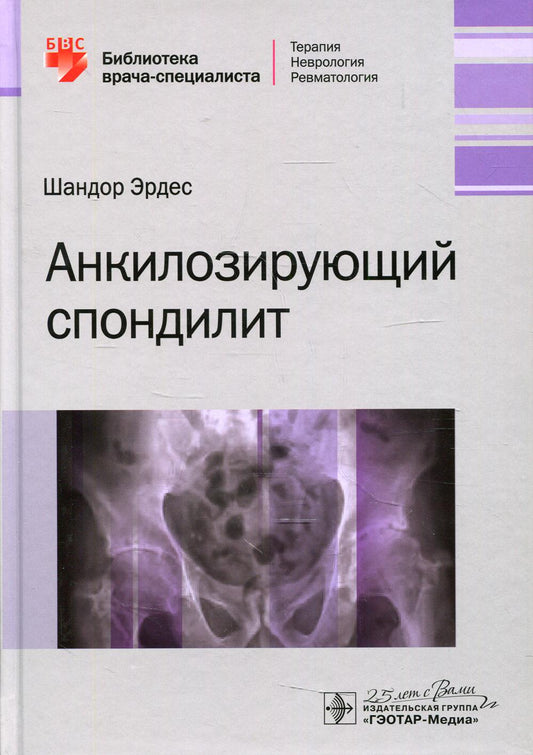 Анкилозирующий спондилит / Шандор Эрдес. — Москва : ГЭОТАР-Медиа, 2020. — 184 с. : ил. — (Серия «Библиотека врача-специалиста»). — DOI: 10.33029/9704-5732-0-ANK-2020-1-184.