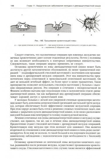 Госпитальная хирургия: Учебник. В 2 т. Т. 2. 2-е изд., перераб. и доп