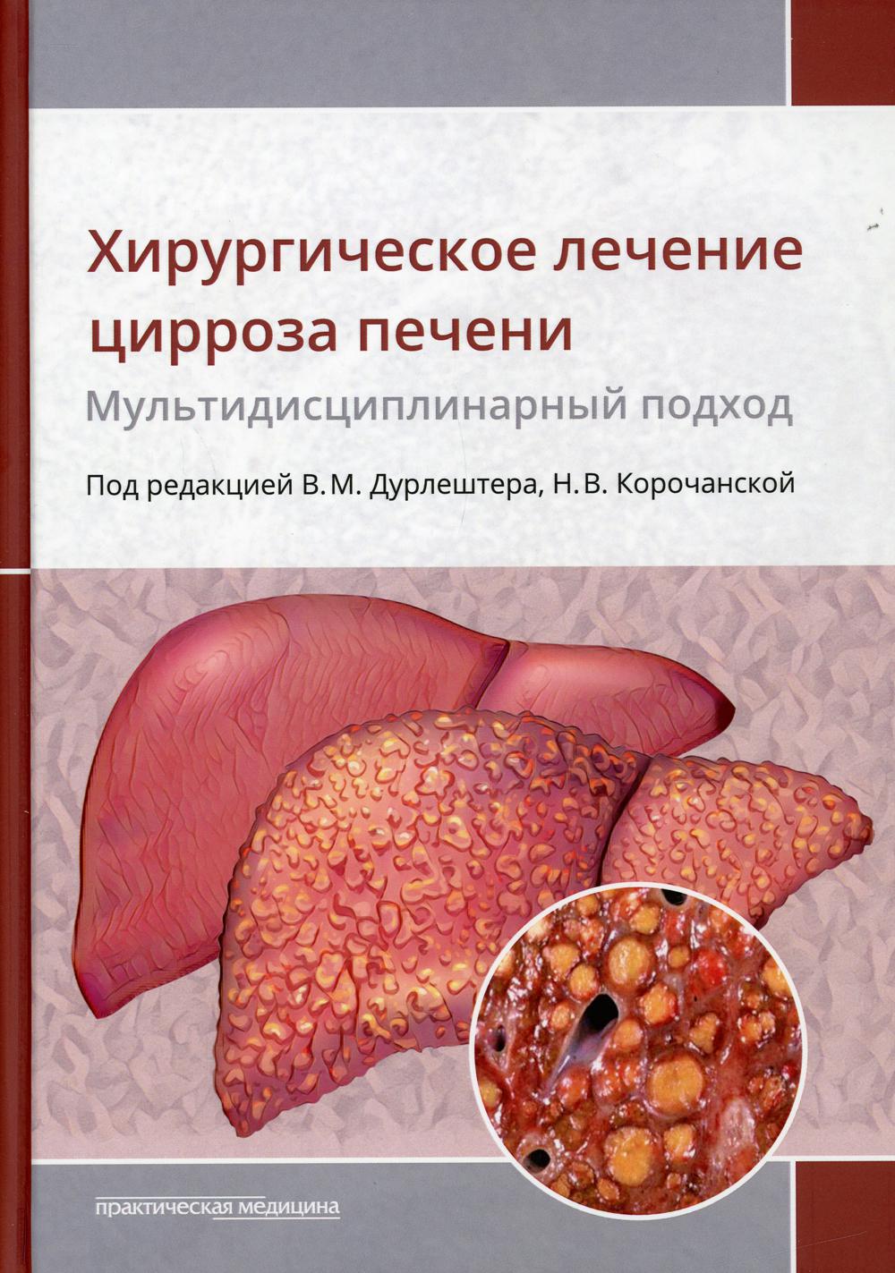 Хирургическое лечение цирроза печени: мультидисциплинарный подход: monographie