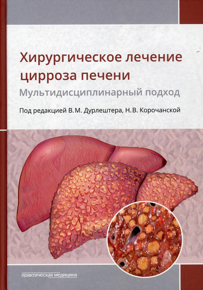Хирургическое лечение цирроза печени: мультидисциплинарный подход: monographie