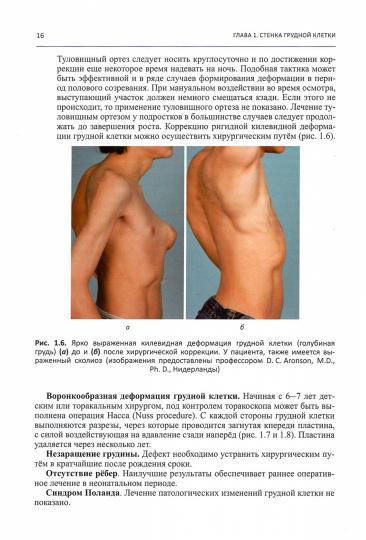 Детская ортопедия. Symptômes, diagnostic différentiel, suivi et traitement supplémentaires
