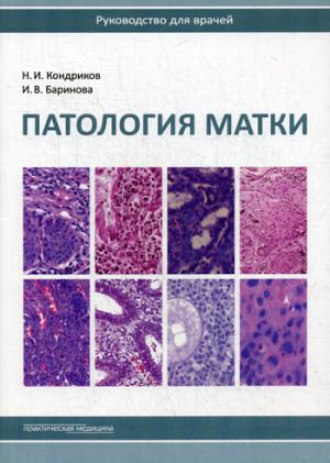 Патология матки. Руководство для врачей. 2-е издание