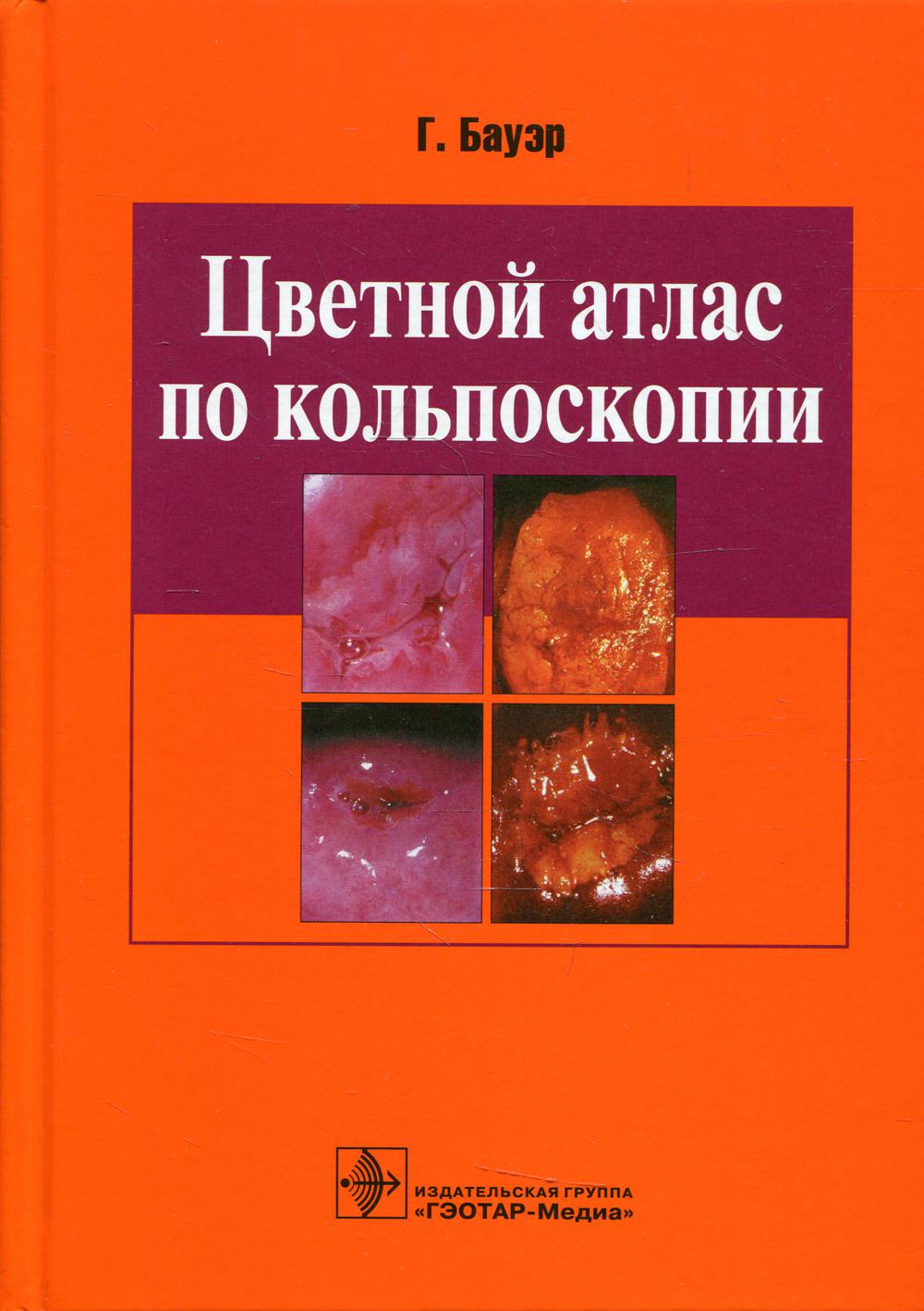 Цветной атлас по кольпоскопии: рук.Бауэр Г.