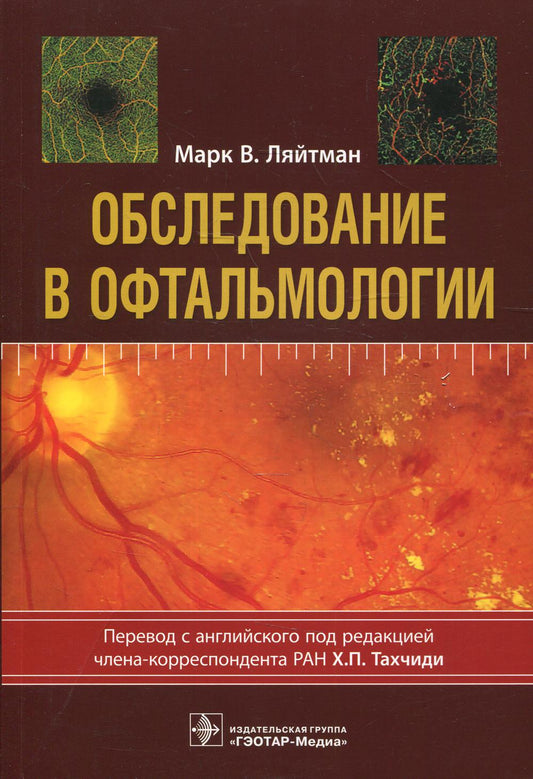 Обследование в офтальмологии / Марк В. Ляйтман ; пер. с англ. под ред. Х. П. Тахчиди. — М. : ГЭОТАР-Медиа, 2019. — 224 с. : ил. — DOI: 10.33029/9704-5062-8-OBS-2019-1-224.