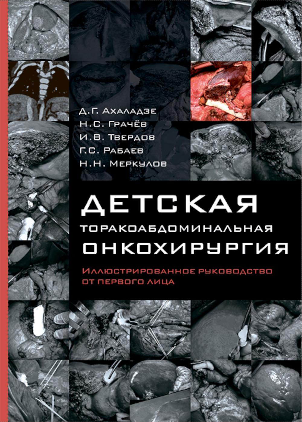 Детская торакоабдоминальная онкохирургия. Exemple de fonctionnement de la première ligne