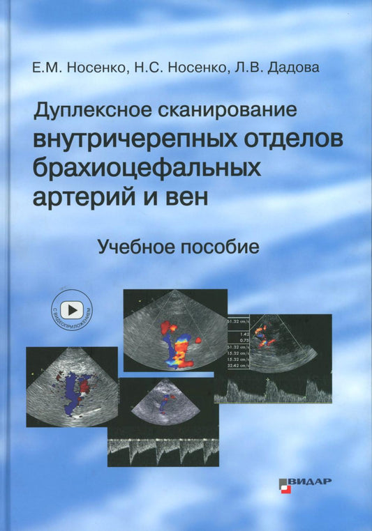 Дуплексное сканирование внутричерепных отделов брахиоцефальных артерий и вен. Учебное пособие